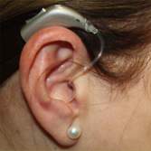 Hearing aid draping over the ear.